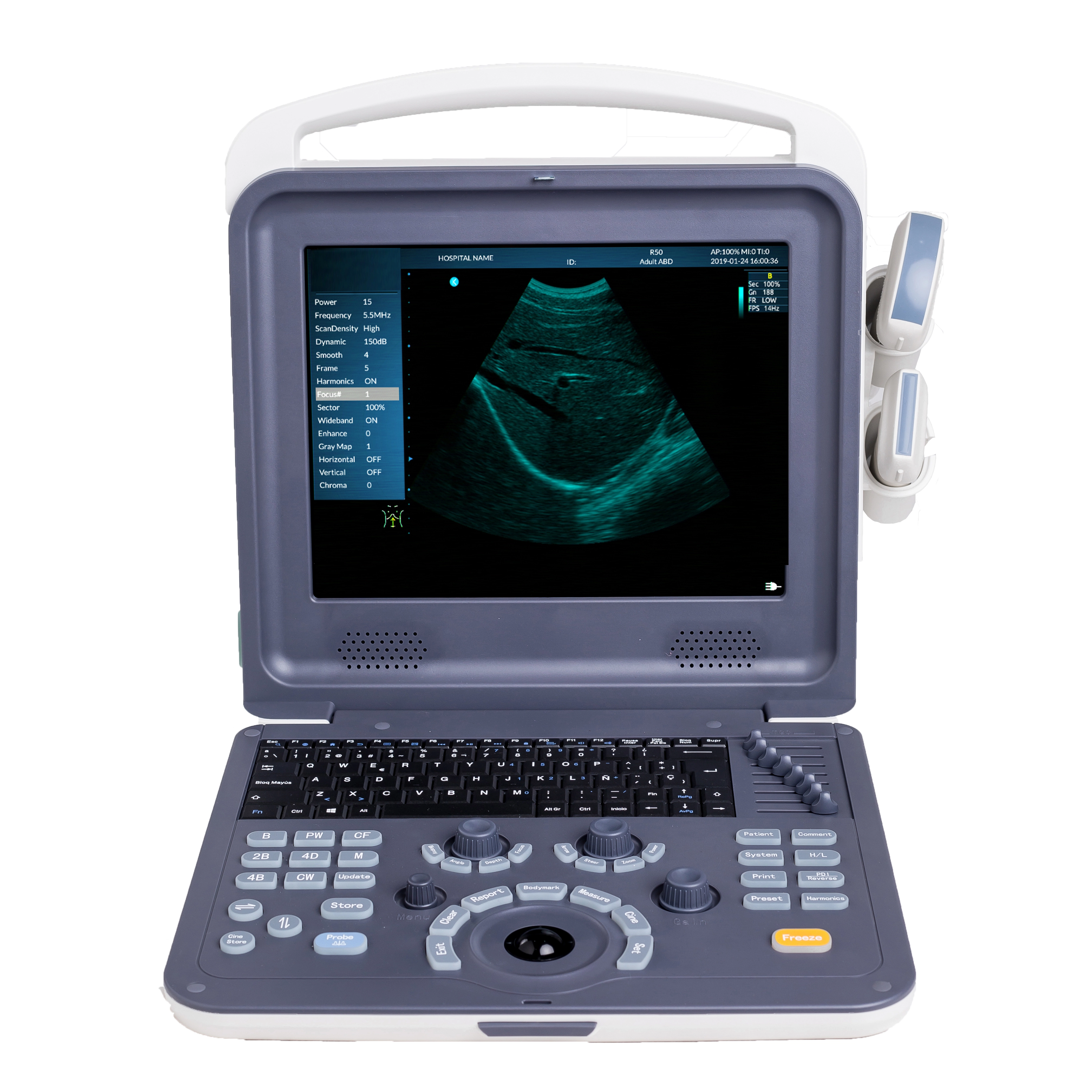 Hospital Equipment Medical Portable Full Digital Color Doppler Ultrasound Scanner | INNORKOM 1