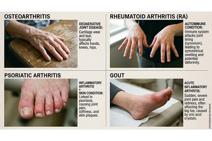 Rotlichttherapie bei Arthritis: Vorteile, Anwendungshinweise und ...