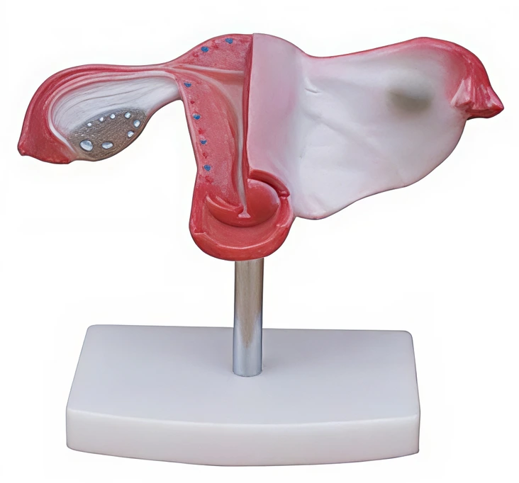 Natural Uterus Model | INNORKOM 1