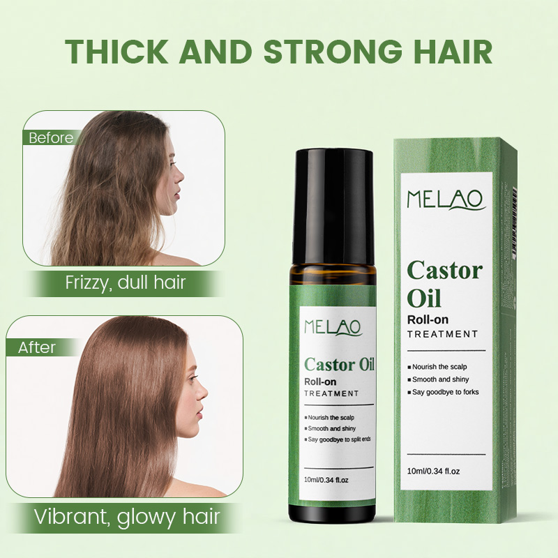 Aceite capilar roll-on con logotipo personalizado, aceite de ricino, tratamiento para el recrecimiento, bloqueador de DHT y tratamiento capilar para cabello dañado. 1