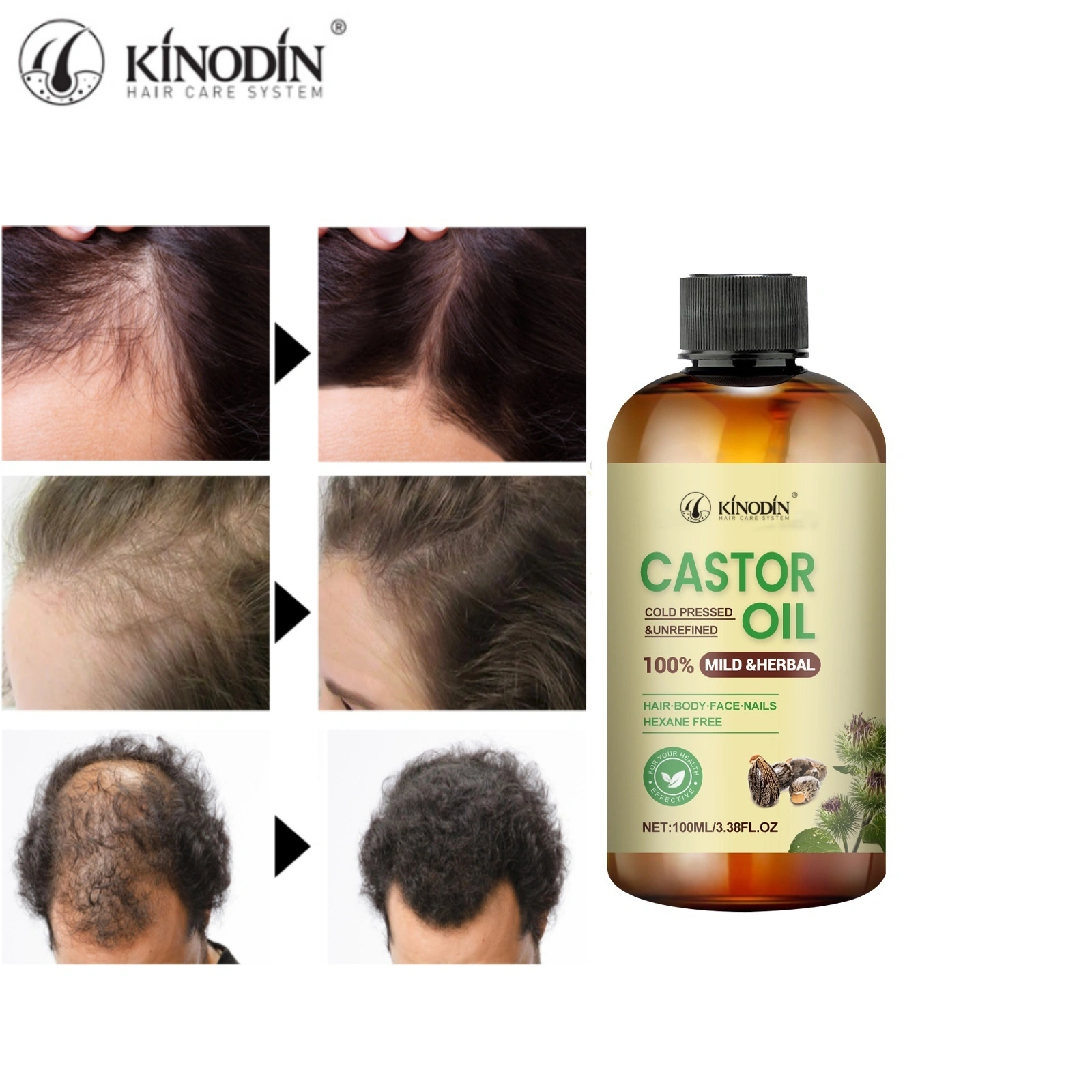 Private Label Custom Natural Rosemary Serum Oil Hair Growth Products Loss Treatment Hair Care Essential Oil For Men And Women 1