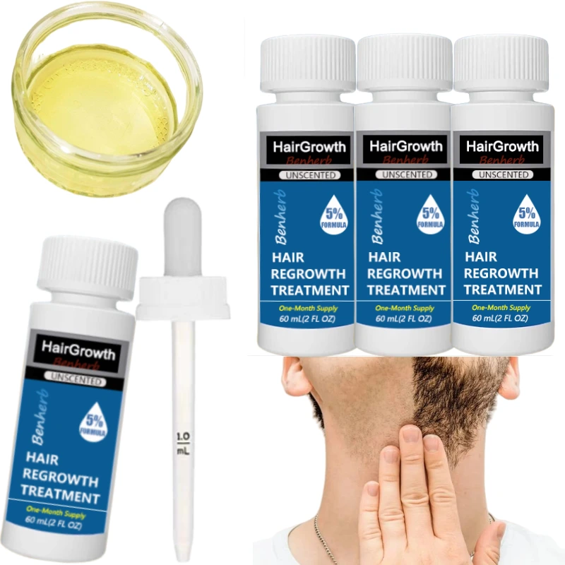 Sérum de tratamento para crescimento capilar orgânico com óleo de rícino 5%, 60 ml, para homens, loção capilar antiqueda com conta-gotas, creme de crescimento 1