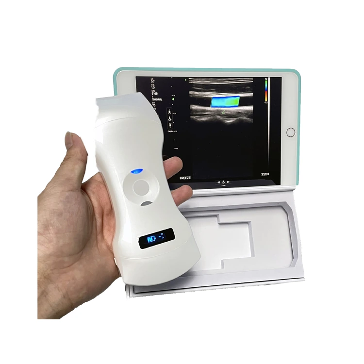 Convex Linear Phased Array 3 In 1 Palm Doppler Ultrasound Wireless Probe Type Ultrasound Scanner 1