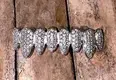 Custom 18K Gold Moissanite Diamond Grillz - Advanced Technology 2