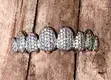 Custom 18K Gold Moissanite Diamond Grillz - Advanced Technology 3