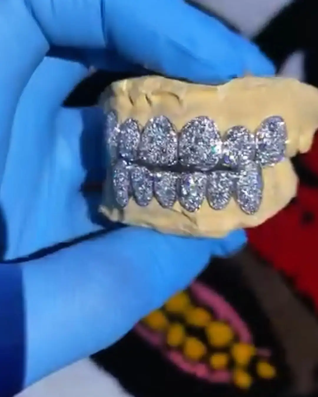 VVS Mosaic Set Grillz Crafted with Precision 1