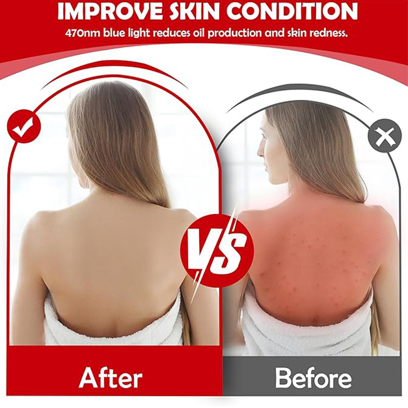 UTK Red & Blue Light Therapy for Body, M3GF1 2