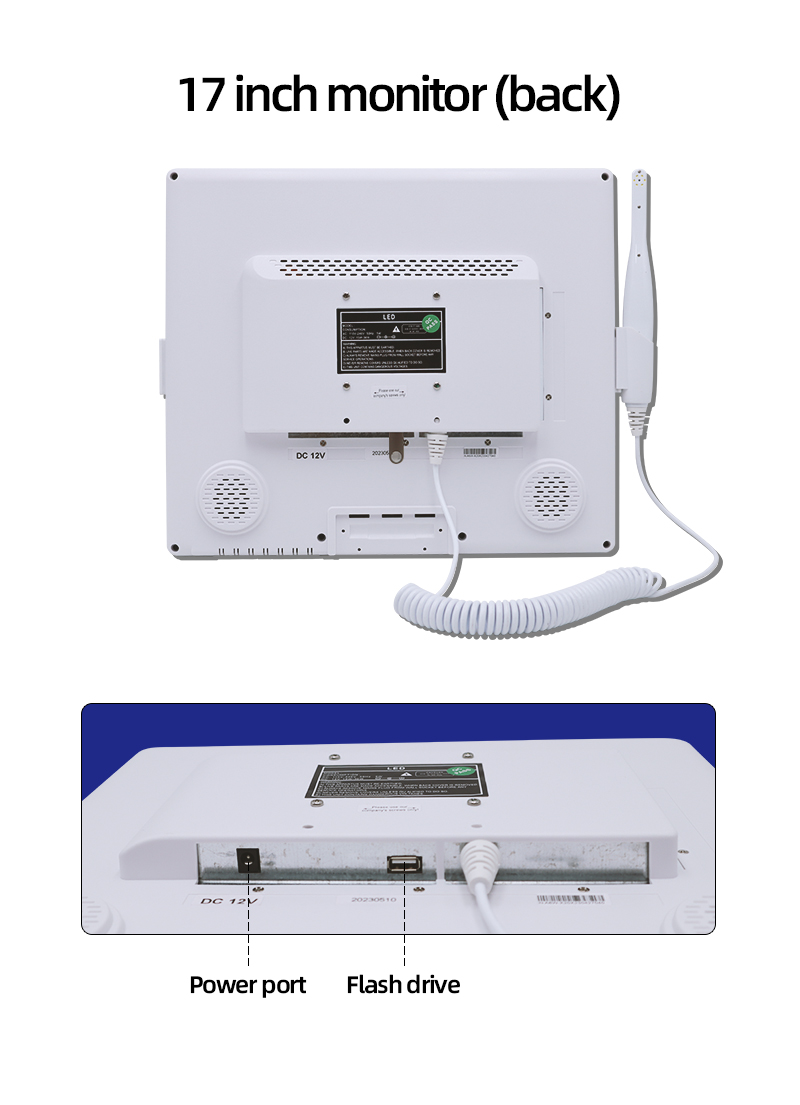 Foshan best supplier high quality dental intraoral camera from China-TK Dental 12