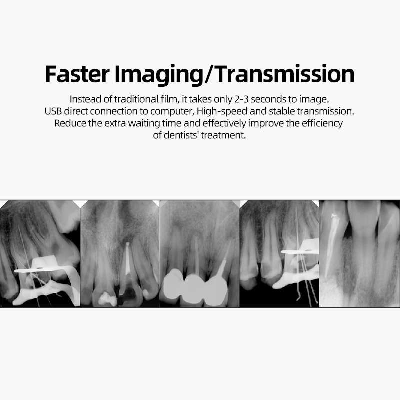 Dental x-ray sensor USB dental digital intraoral x ray sensor price 6