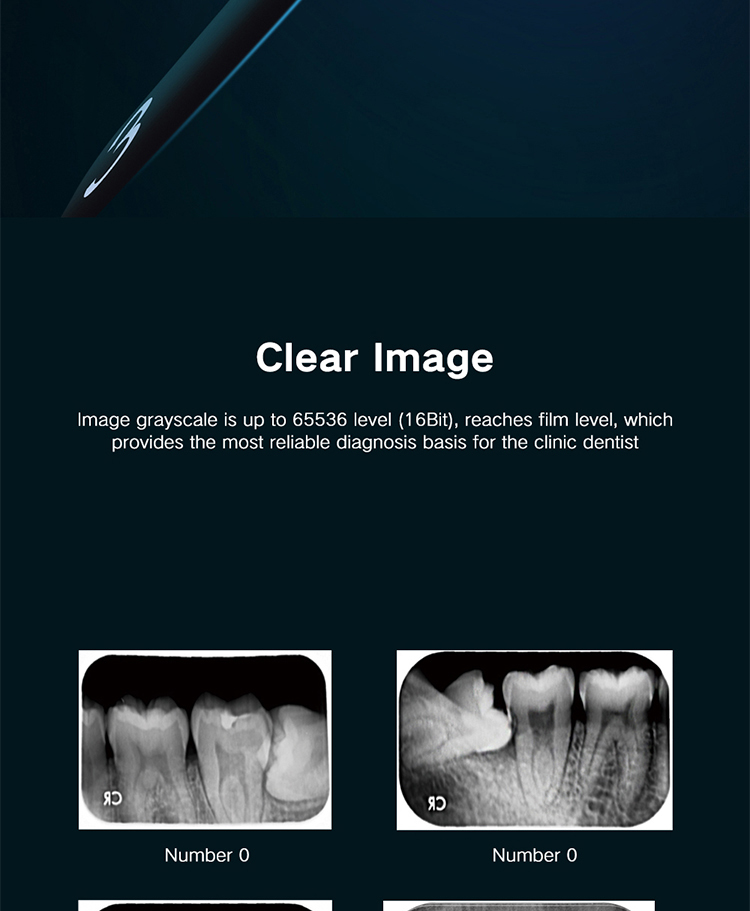 TKV-009 Dental Digital Intra Oral Xray PSP Phosphor X-ray Imange Plate Scanner Imaging System 6