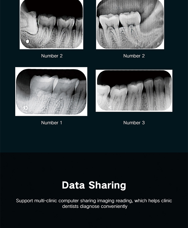 TKV-009 Dental Digital Intra Oral Xray PSP Phosphor X-ray Imange Plate Scanner Imaging System 7