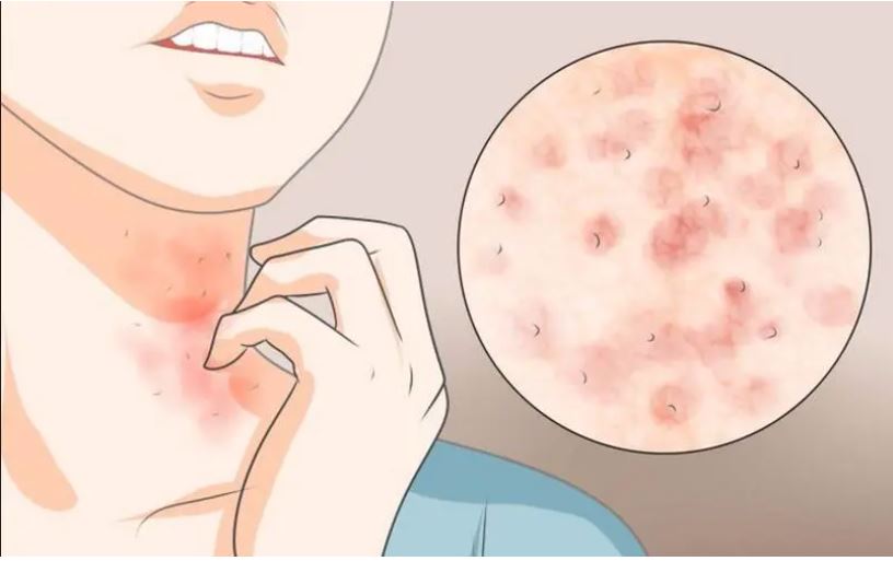 How to Tell The Difference Between Platinum, Silver and White Gold 6