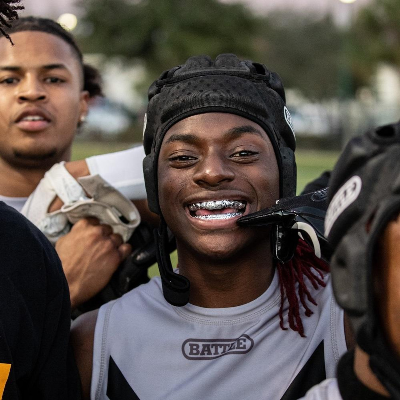 Grillz: The evolution of fashion from ancient times to modern times 1