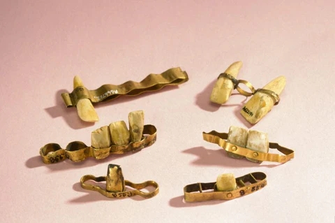 Grillz: The evolution of fashion from ancient times to modern times 2
