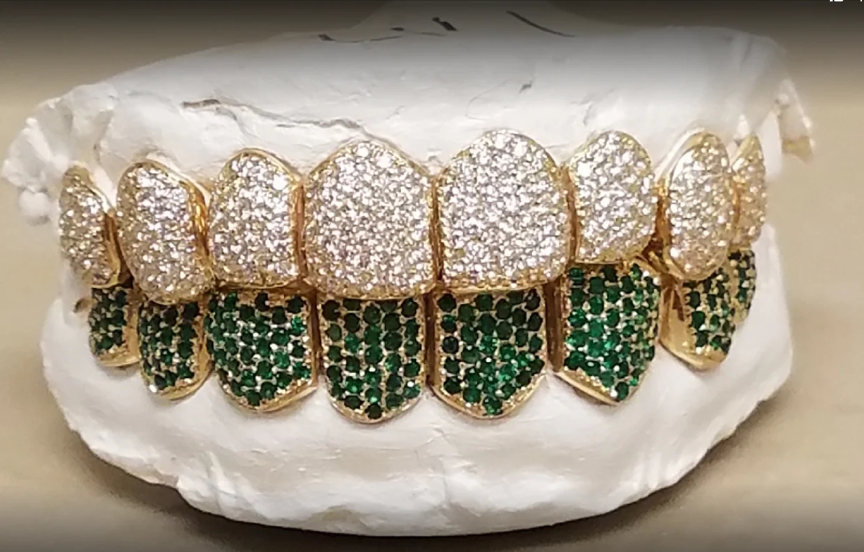 Grillz: The evolution of fashion from ancient times to modern times 6