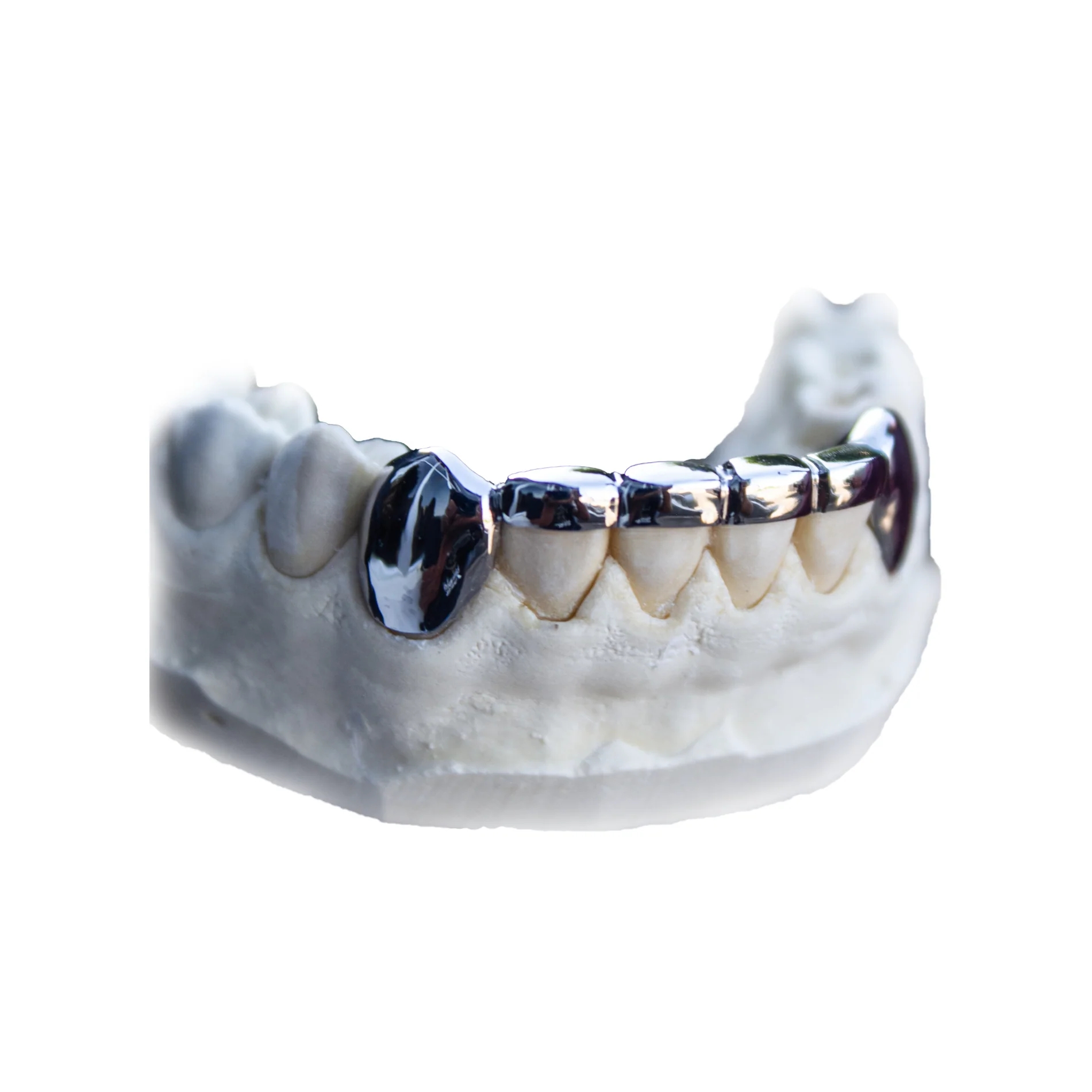 Grillz: The evolution of fashion from ancient times to modern times 7