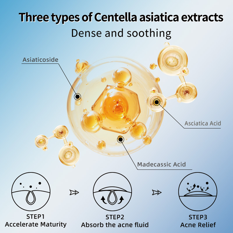 AUSLKA 48 Patchs Hydrocolloïdes Ronds Transparents Anti-Acné pour Traitement Localisé 5