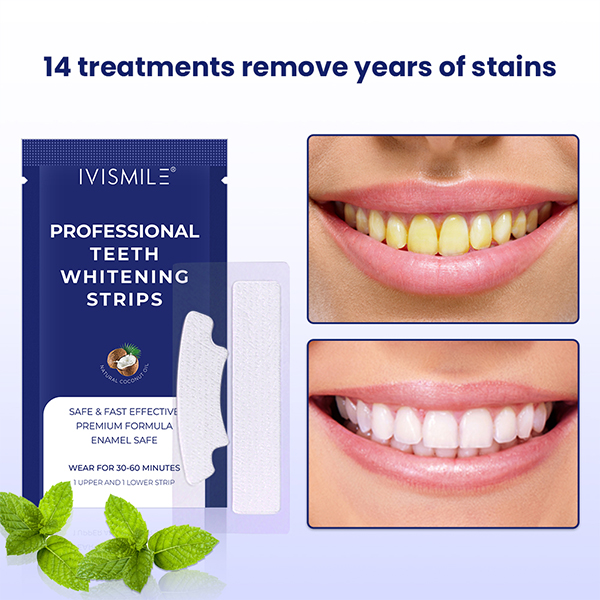 Tiras blanqueadoras dentales profesionales OEM para dientes sensibles 2