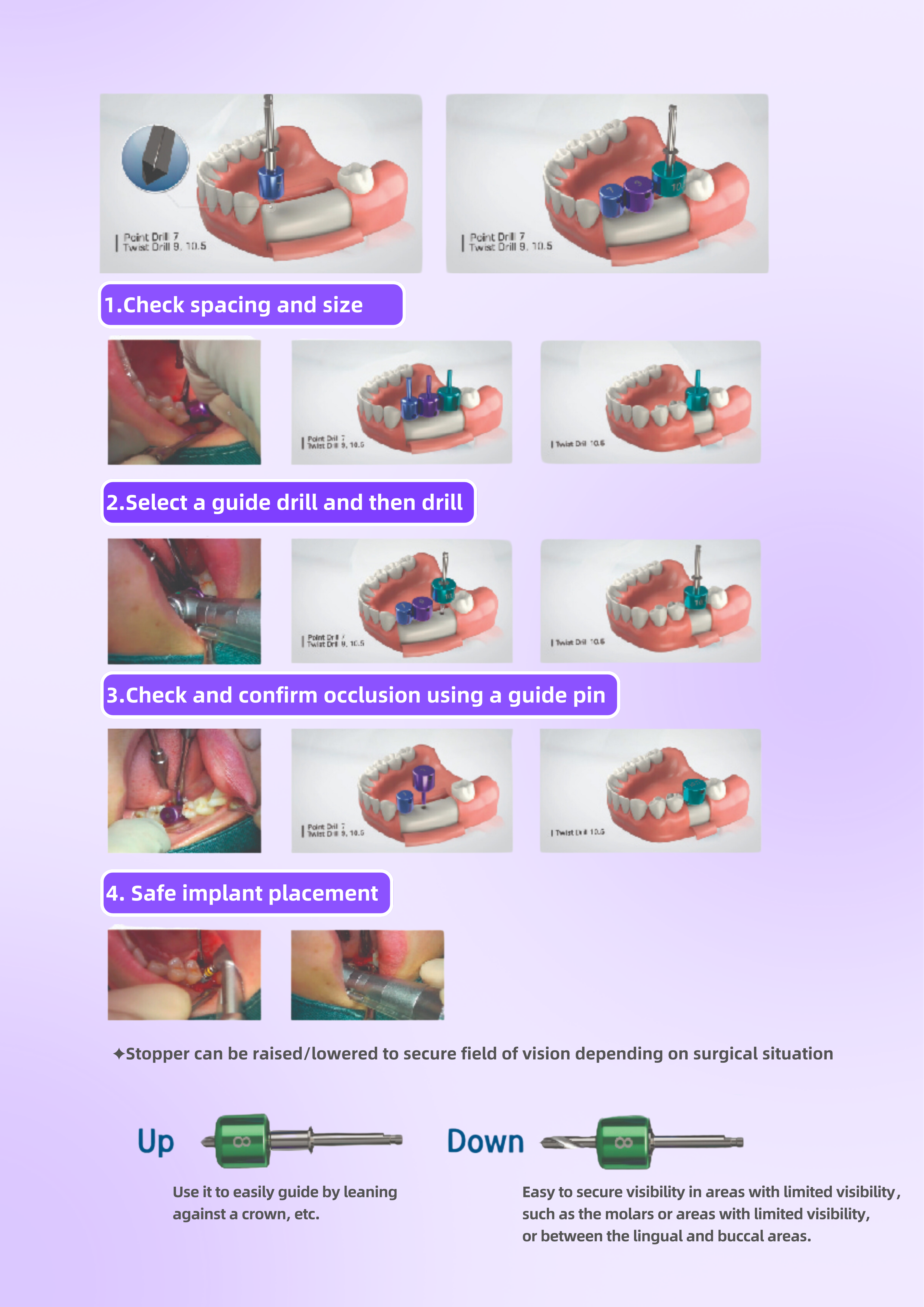 WISEDENT - Dental Manufacturer Implant Positioning Kit Implantes Dentales Position Locator BR-412T-3 10