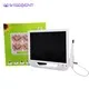 HD Macro Lens Intra Oral Camera - Wisedent Quality Dental Imaging 2