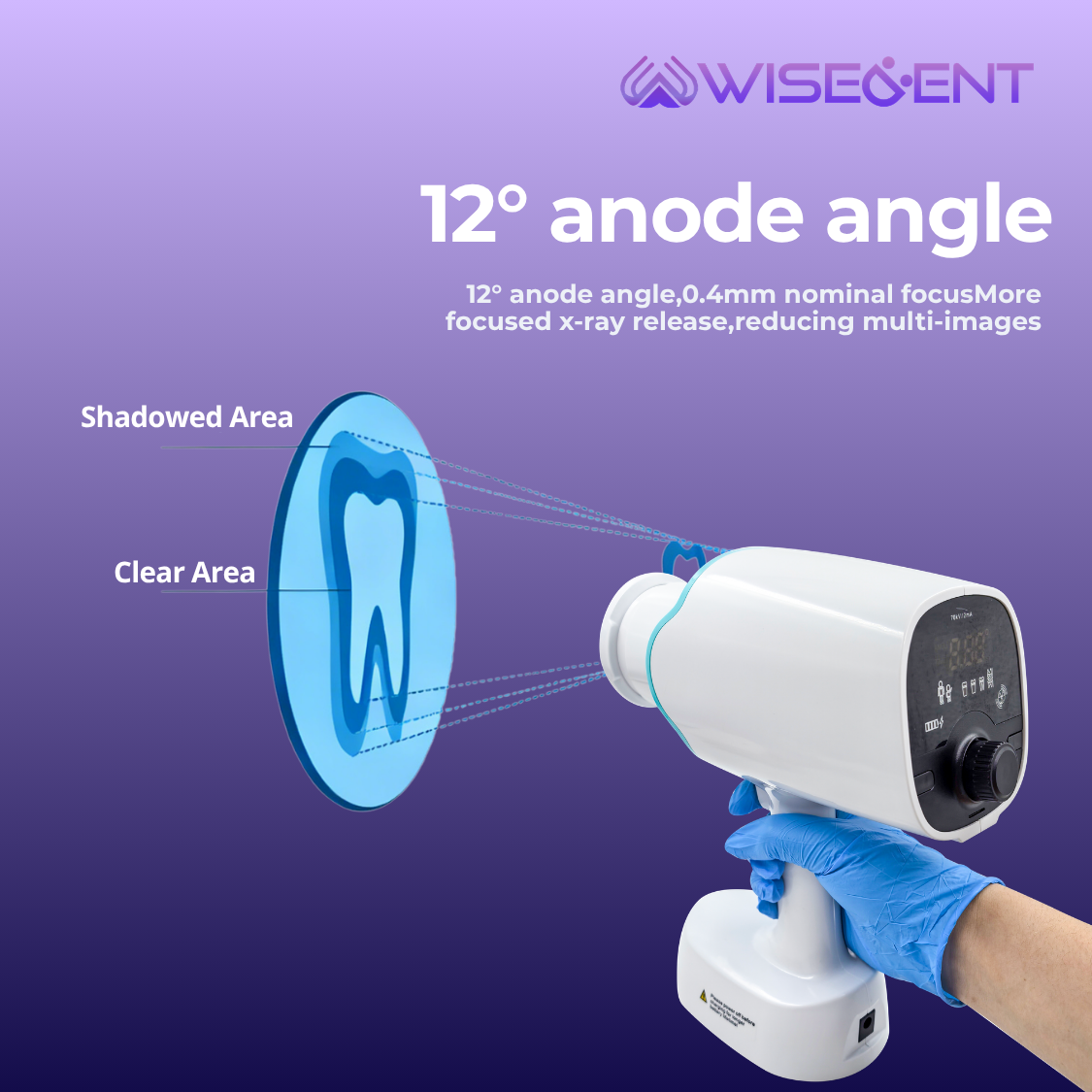Hot Sale Wisedent Portable Dental X‑Ray Machine 70kV 2mA Rechargeable Hand‑held X‑ray Unit Adult- WISEDENT 12