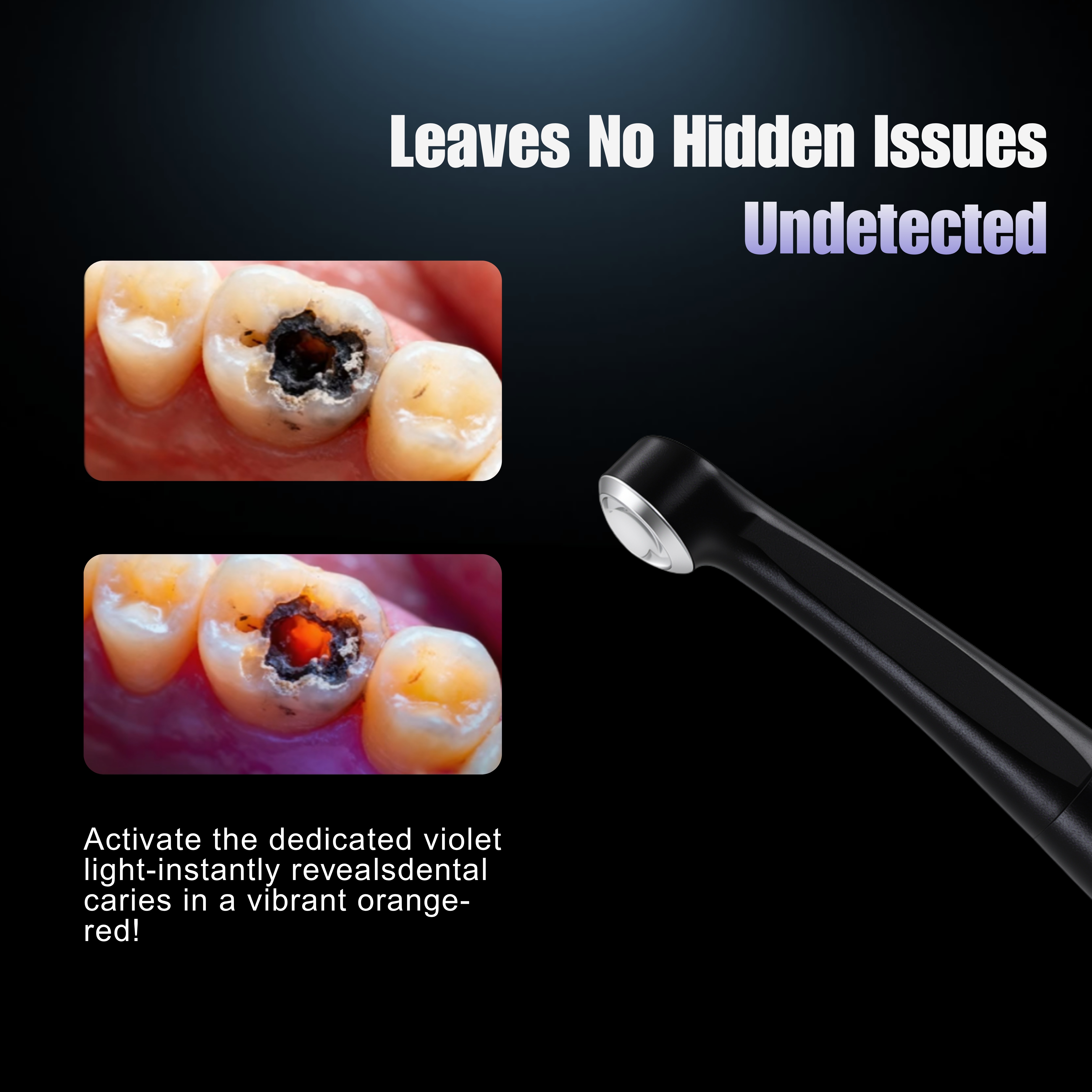 WISEDENT - High End Dental Curing Light LED Wireless Light Cure Lamp with LCD Display and Charging Base BR-618Pro1 13