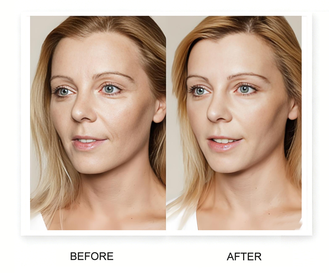 超声刀效果对比图75