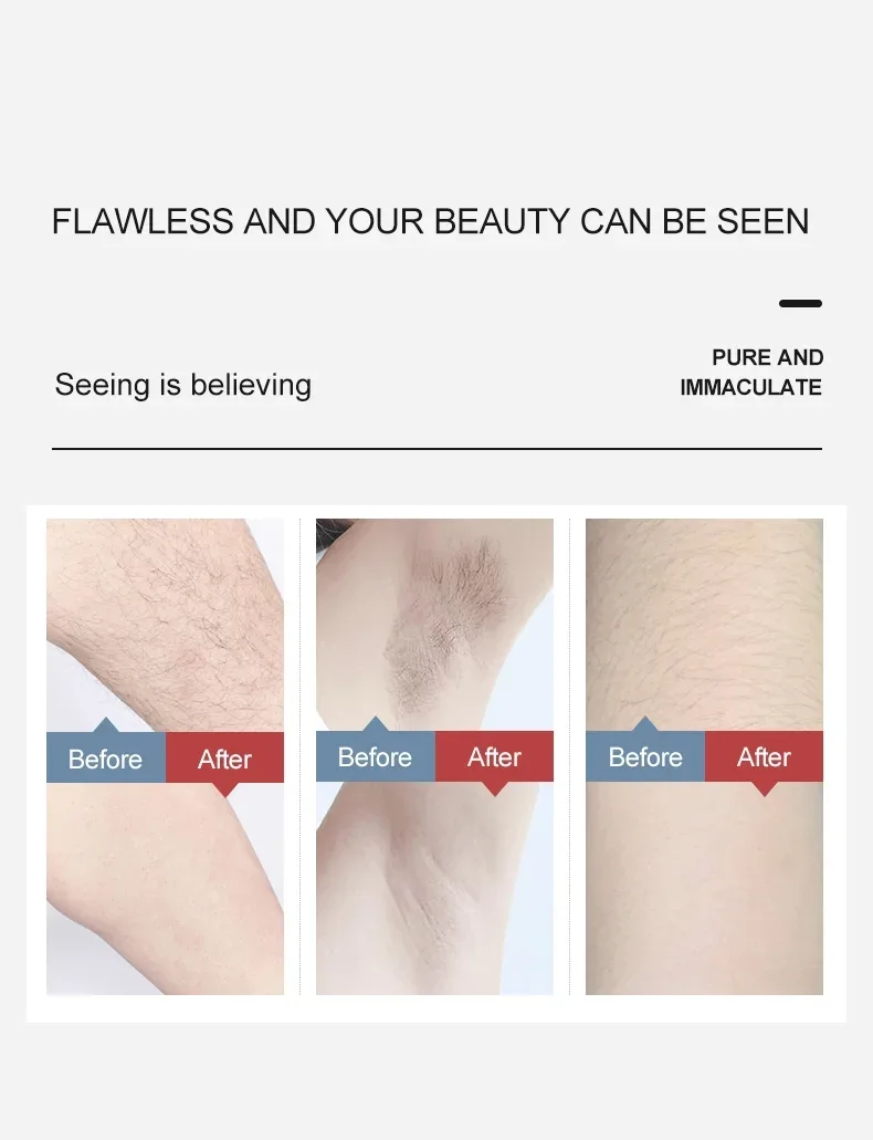 Reliable Cooling Ipl Hair Removal Company Mismon 6