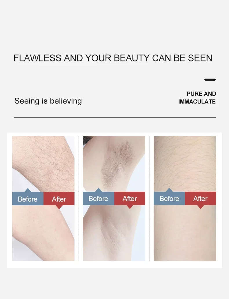High-Endipl Cooling Hair Removal Device Fa'a'a'alili Aisa 7