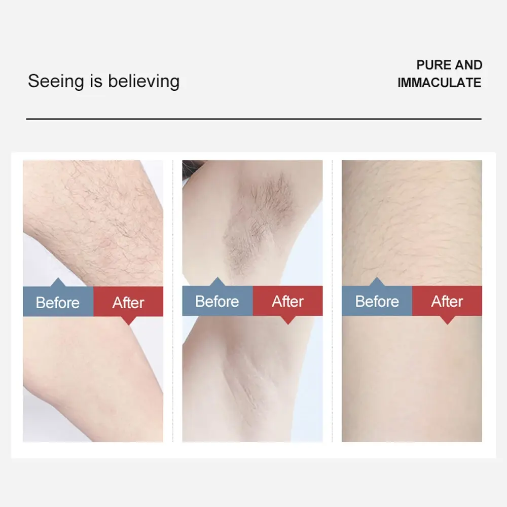 Home Ipl Hair Removal MS-208B for Home Usemanufacturers 7