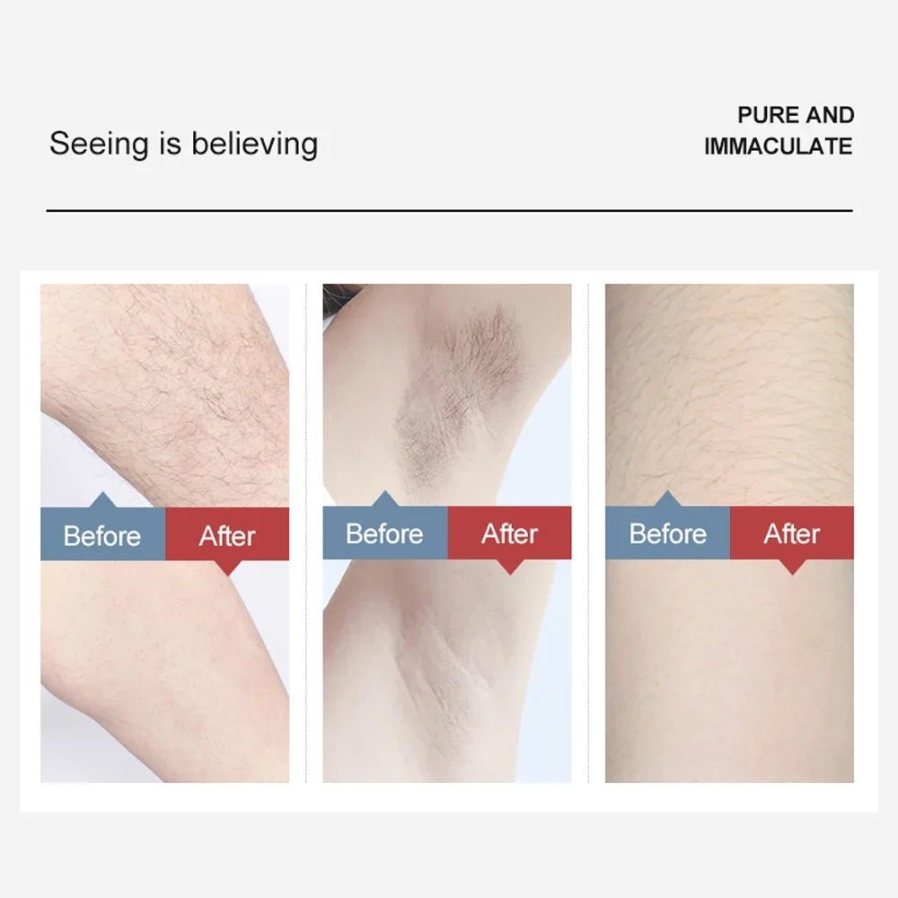Ice Cool Ipl Hair Removal 999999 Błyski - - Mismon 7