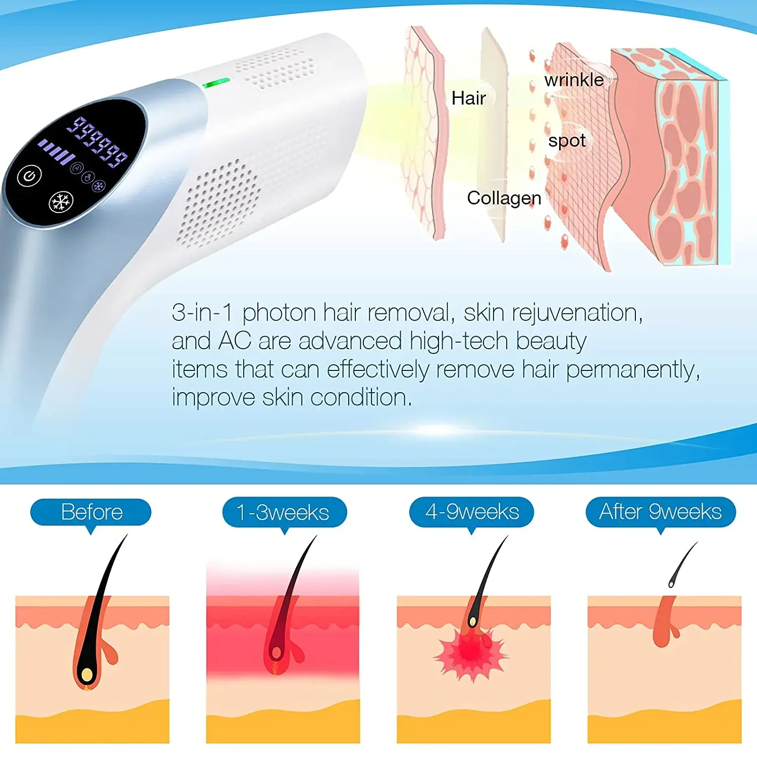 Reliable Ipl Hair Removal Machine Manufacturer Price List 4