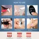 Mismon Ipl Hair Removal Machine S-HR Ipl Mga Supplier ng Hair Removal Machine 6