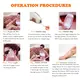 Topipl Hair Removal Machine Supplier Online Support Skin Rejuvenation 6