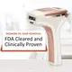 ឧបករណ៍ដកសក់ Ipl ល្អបំផុត IPL Hair Removal NOmanufacturers 3