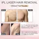Cost-effective Wholesale Ipl Hair Removal Machine Wholesale Ipl Hair Removal Machine Company 7