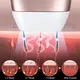 Wholesale Ipl Hair Removal Device Company 7