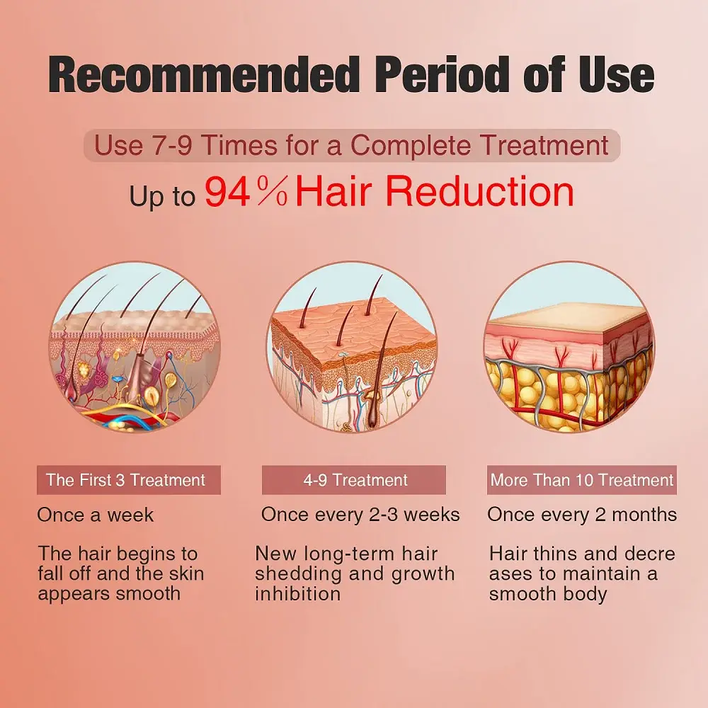 Misona | Fa'afouga leisa Hair Removal System Factory 5