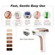 Ipl Machine Bulk ទិញ IPL Mismon 5