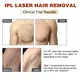 Ipl Equipment Suppliers Mismon ბრენდი 10-15J დიახ 6