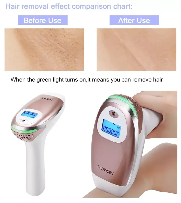 I-Mismon Laser yokuSuswa kweNwele inkqubo-1 5