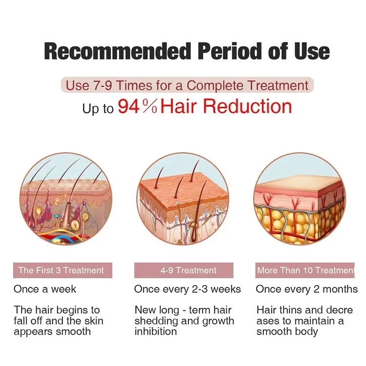 OEM Best Home Ipl Hair Removal Mismon IPL 4