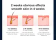 Sapphire Ipl Hair Removal Company Hair Removal 4