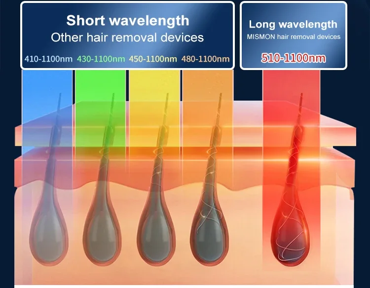 Sapphire Ipl Hair Removal Company háreyðing 6