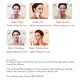 Wholesale Ipl Hair Removal Supply NO 3