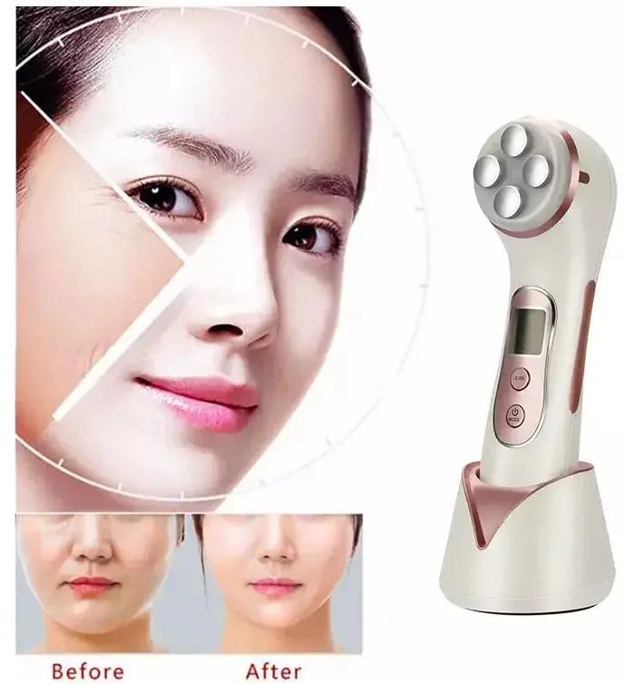 အိမ်သုံး မျက်နှာအလှပြင်ကိရိယာအတွက် Mismon Rf အရေပြားတင်းကျပ်သည့်စက် 2