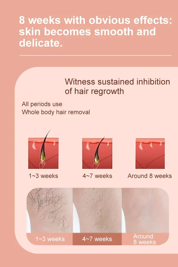 Innovative Ipl Hair Removal Equipment Manufacturer Ipl Hair Removal Equipment Manufacturer Company 5