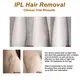Mismon Wholesale Ipl Hair Removal Machine MS-208B 6