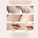 Cost-effective Ipl Hair Removal Machine Manufacturer Suppliers 5