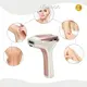 Ipl Machine Bulk ទិញ IPL Mismon 1